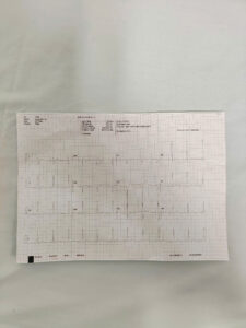 máy điện tim 12 cần